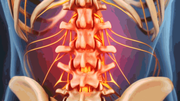 Gif showing lower back pain.