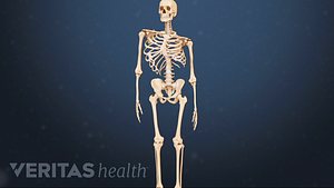 Medical illustration of an adolescent skeleton with scoliosis