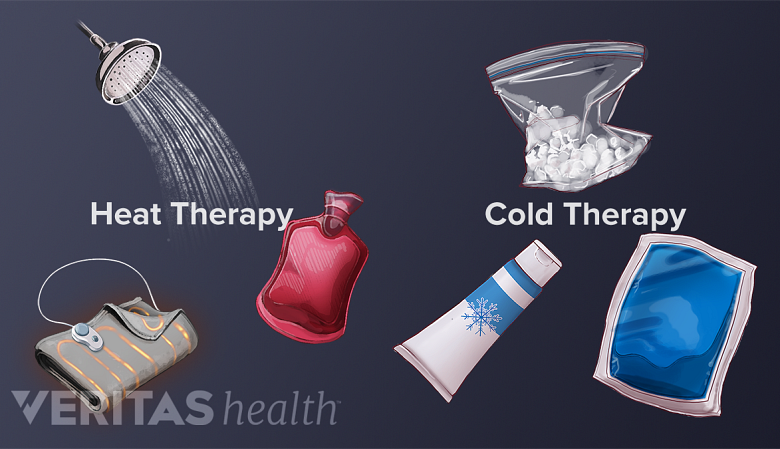 An illustration showing different types of cold and heat therapy.