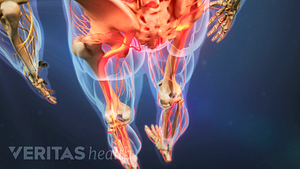 Vista posterior de la parte inferior del cuerpo con el nervio ciático resaltado en rojo, lo que indica dolor, entumecimiento u hormigueo