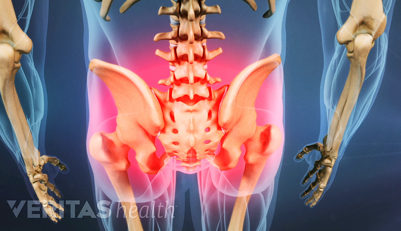Highlighted area showing muscle tightness and pain in the lower back and pelvis.